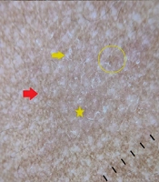 J Skin Stem Cell